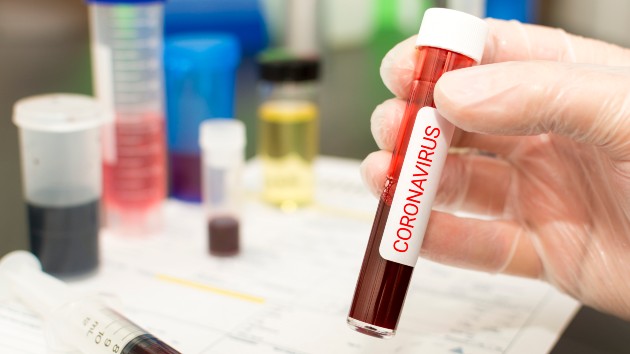 istock_32020_covidtestblood
