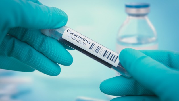 istock_32620_covidtubegloves