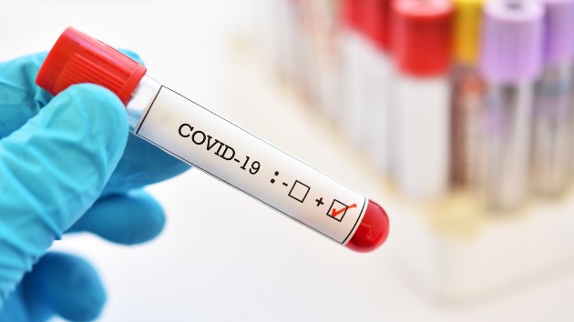 istock_4820_covid19testtubesingle