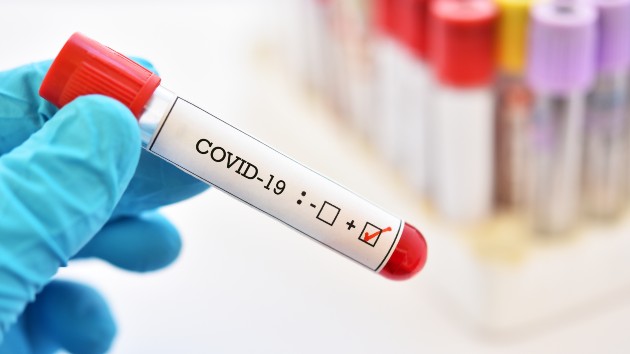 istock_41520_covid19postest