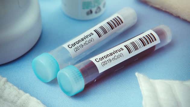 istock_41620_covidtesttubes