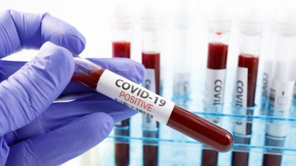 istock_52820_covidtest