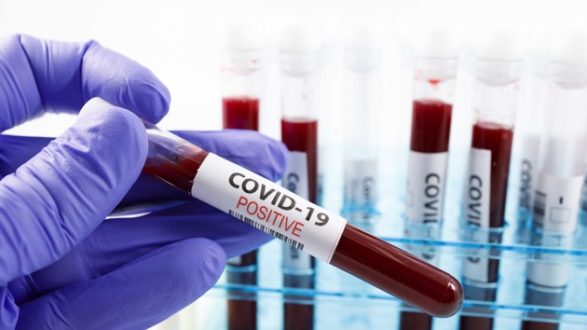 istock_071420_covidupdates