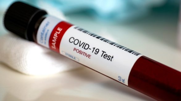 istock_8320_covidbloodsample