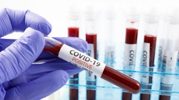 istock_92520_covidpossample