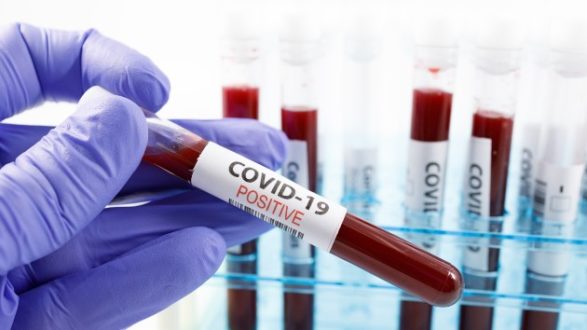 istock_92920_covidposbloodtest