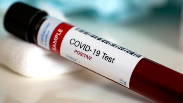 istock_101620_covidtesttube201