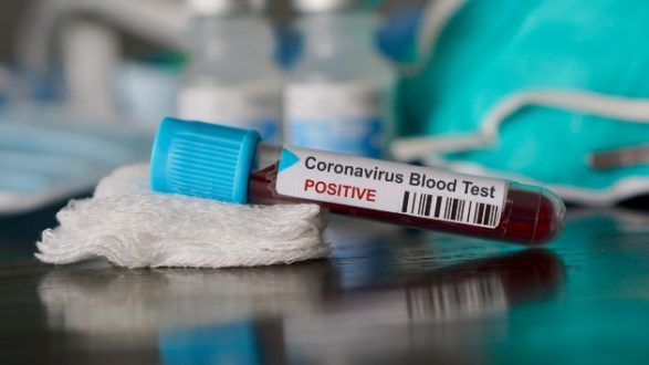 istock_111220_covidvialblood