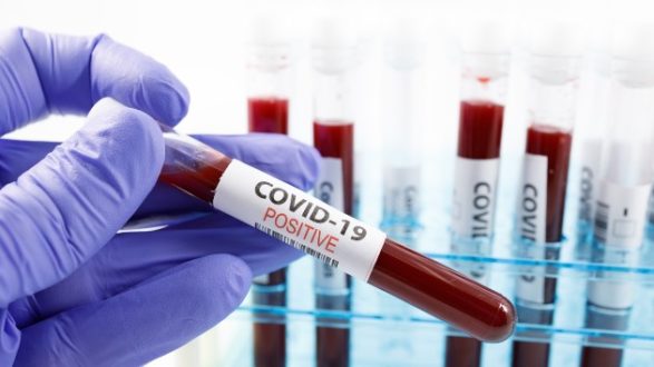 istock_121520_covidbloodpos