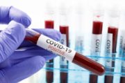 istock_11321_covidbloodpossample