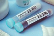 istock_11921_covidbloodsamplestubes