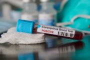 istock_12221_covidbloodsample