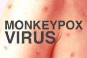 wireready_06-19-2022-23-04-03_00135_monkeypoxvirus