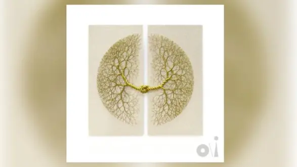 m_beenundone_010526862755