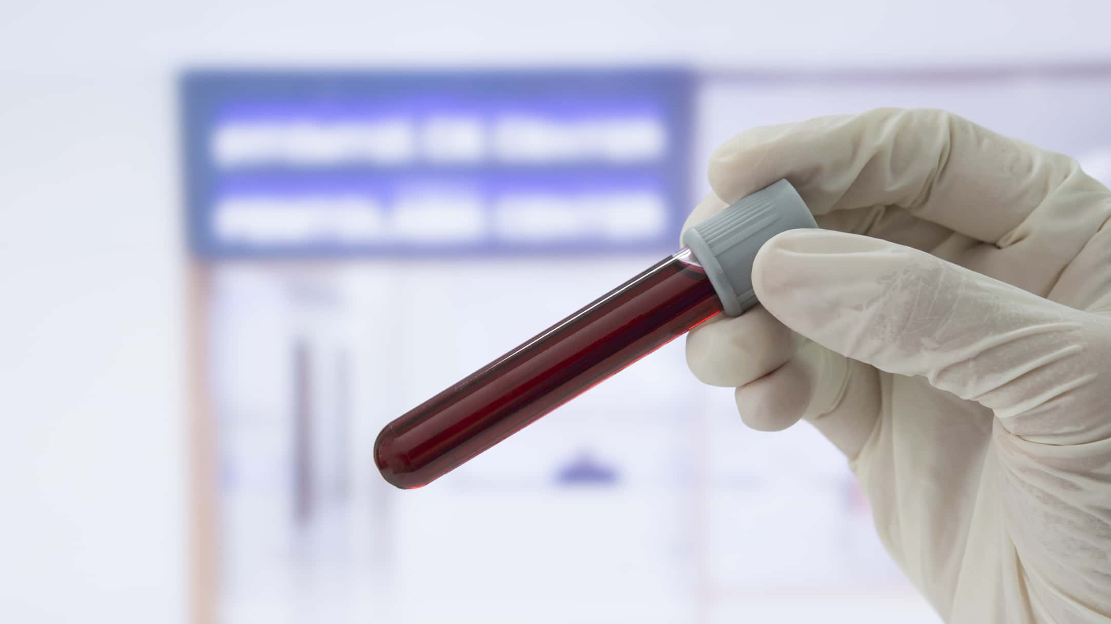 getty_091018_bloodtest