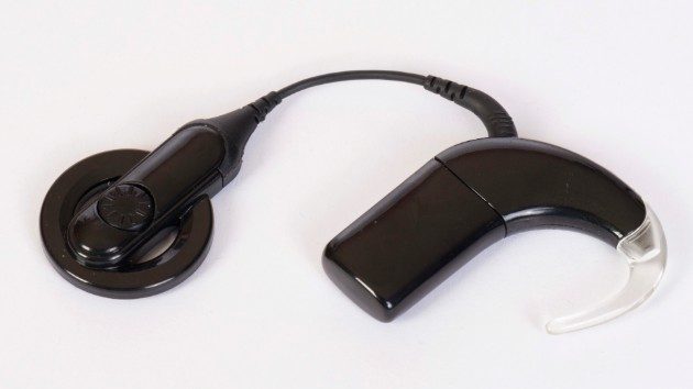 istock_62619_cochlearimplant