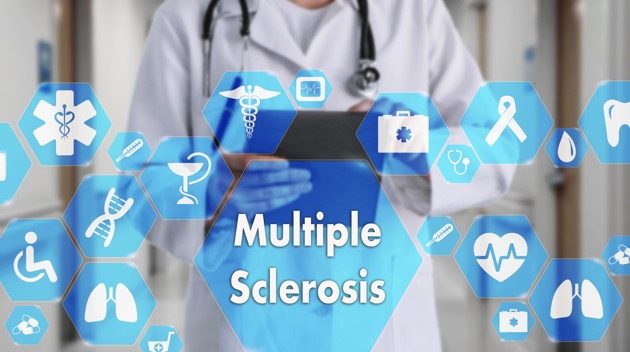 istock_080119_msselmablairstem