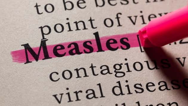 istock_091619_measles
