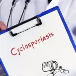Health care concept meaning Cyclosporiasis with sign on the sheet.