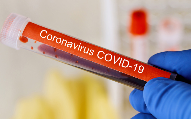 coronaviruscovid-3
