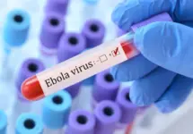 Doctor holding a test blood sample tube with Ebola virus test on the background of medical test tubes with analyzes.