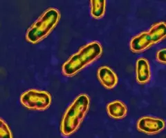 getty_plague_082625884038