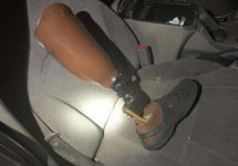 prostetic-leg-in-seat-of-car-jpg