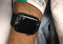 smashed-apple-watch-with-hospital-bracelet-png-2