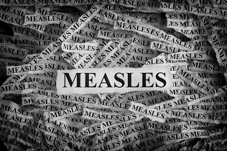measles-torn-pieces-of-paper-with-the-words-measles-concept-im