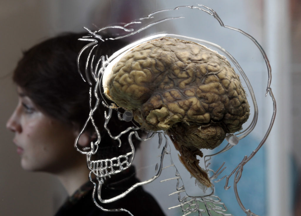 the-real-brain-exhibit-bristol-science-centre
