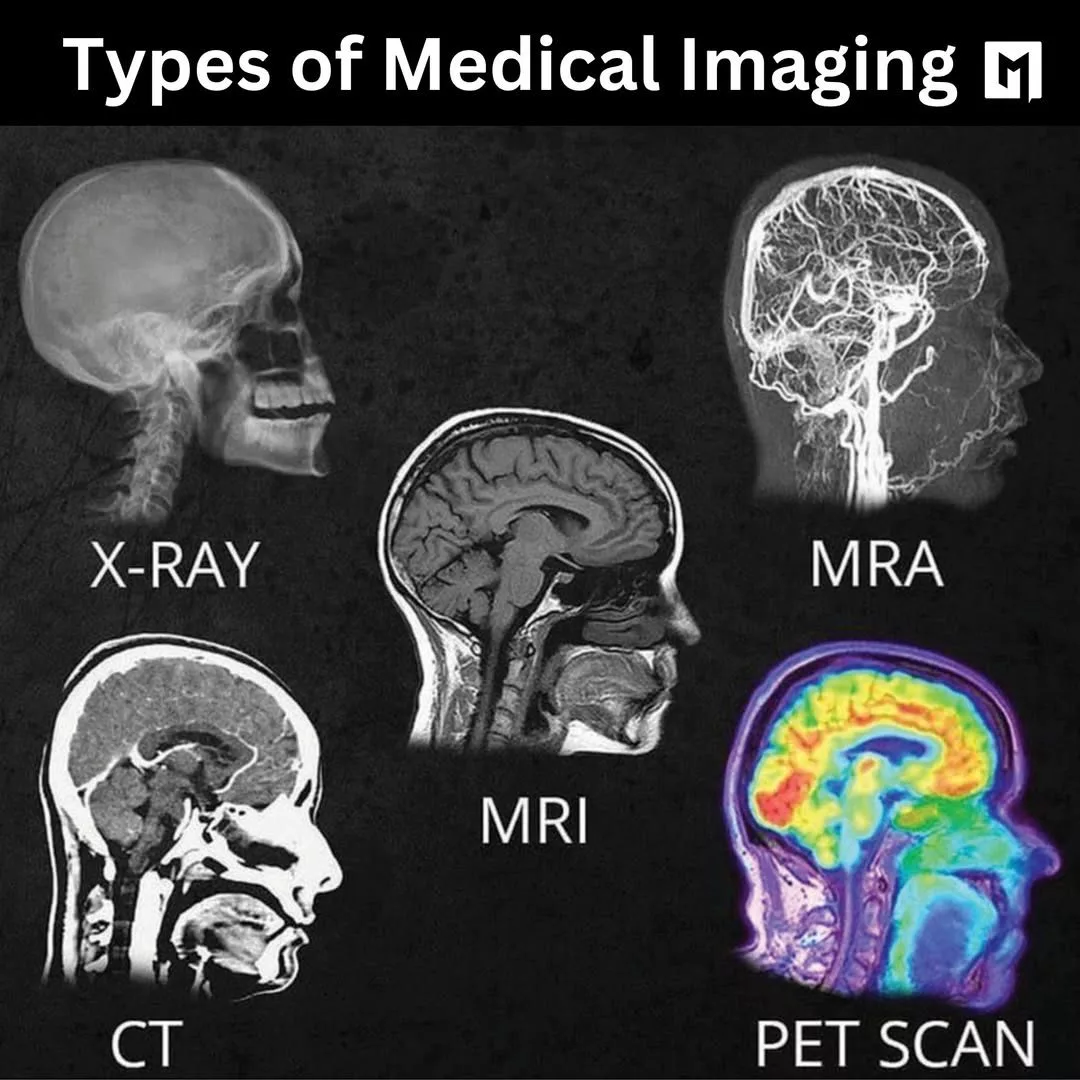 MRI