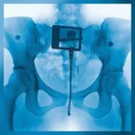 m_lordevirgin_043035126112