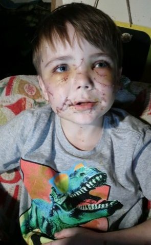 conner-landers-dog-attack-pcso-facebook