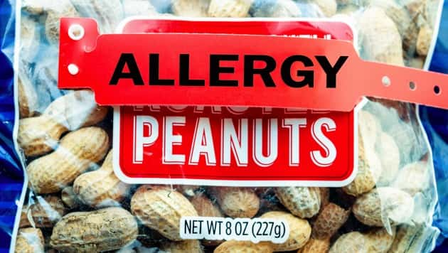 istock_020320_peanutallergies