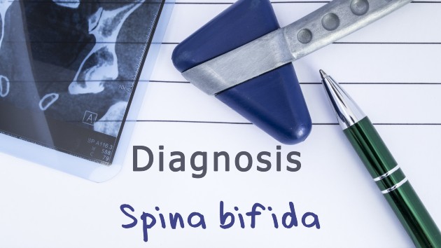 istock_2620_spinabifida