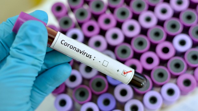 istock_2620_coronavirus