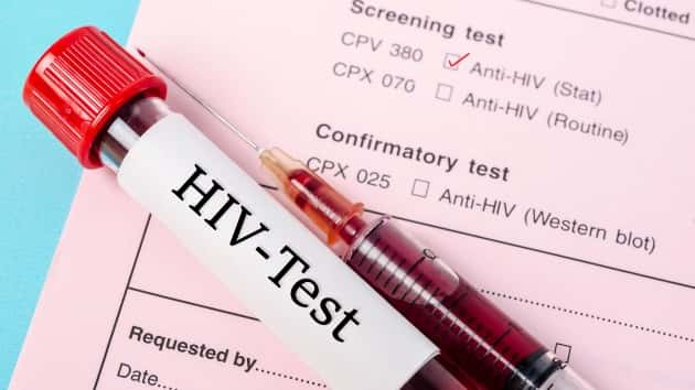 istock_21020_hivtest-2