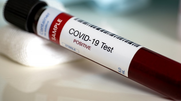 istock_coronavirus_070420