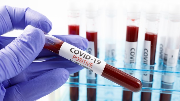 istock_111020_covidbloodtesttube