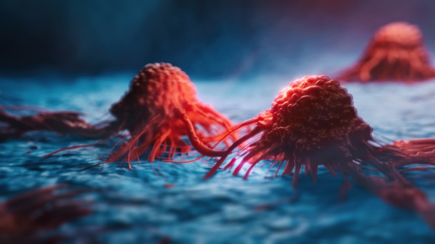 istock_cancercells_070821