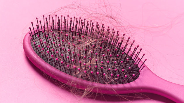 gettyrf_12222_hairlossbrush2028129