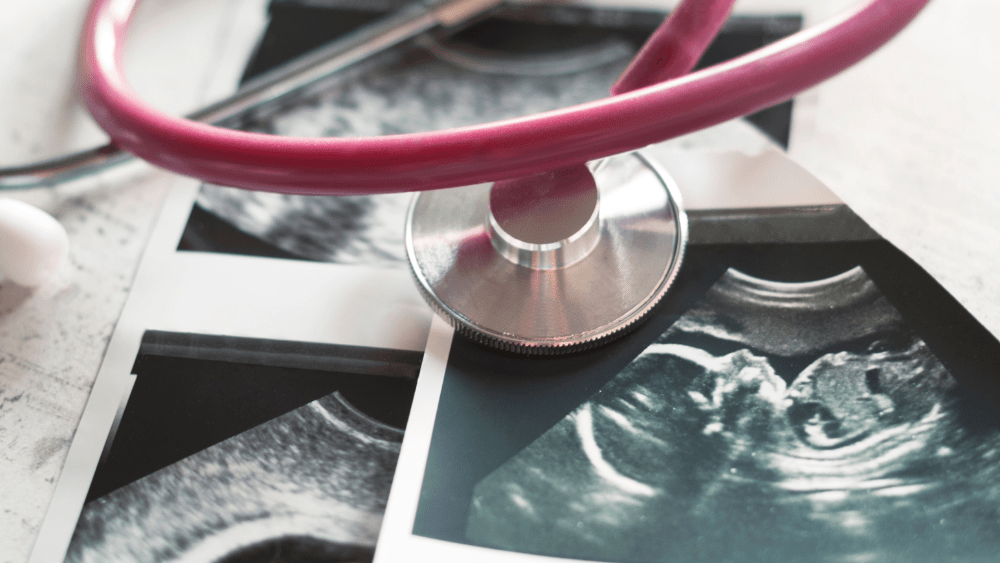 covid-pregnancy-png